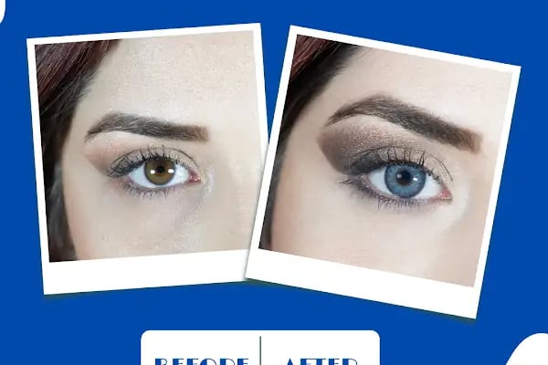 Hadim optik & lens - Resim 8