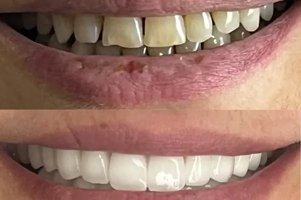 La Denta - Resim 3
