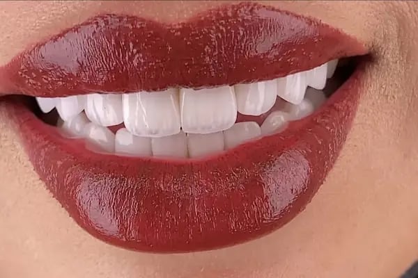 La Denta - Resim 5