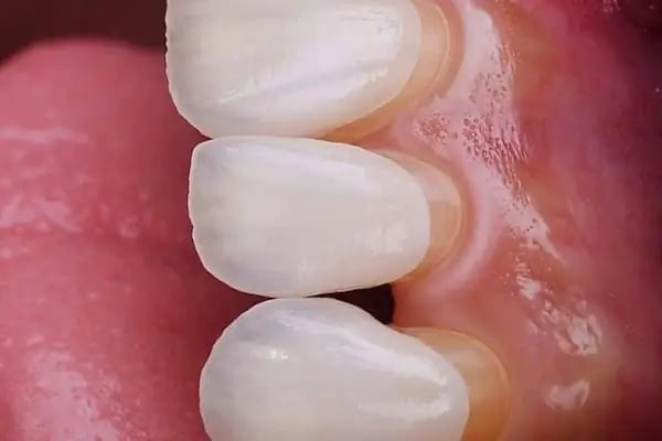 La Denta - Resim 9