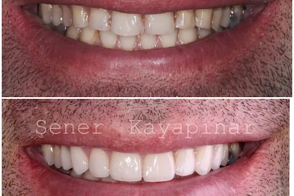Dr. Şener KAYAPINAR Diş Kliniği - Resim 10