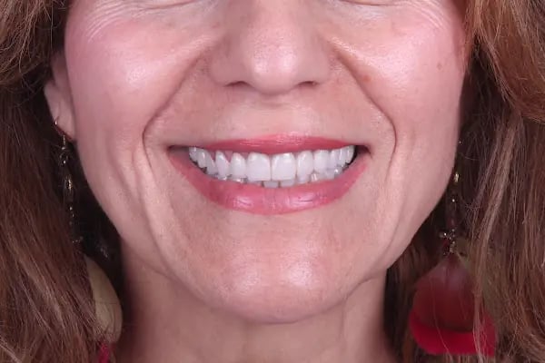 Dr. Şener KAYAPINAR Diş Kliniği - Resim 17