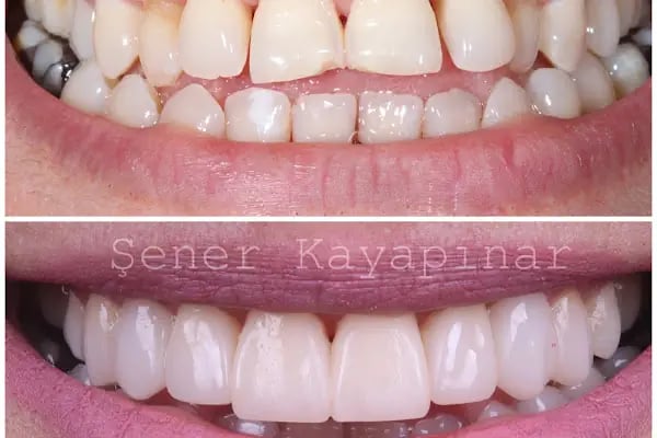 Dr. Şener KAYAPINAR Diş Kliniği - Resim 14
