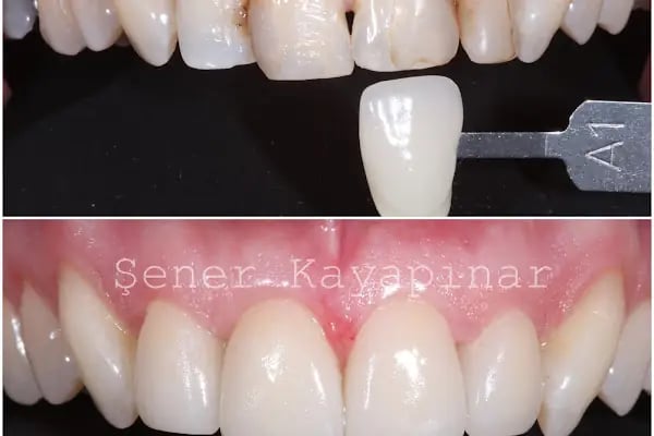 Dr. Şener KAYAPINAR Diş Kliniği - Resim 12