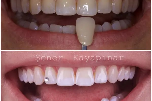 Dr. Şener KAYAPINAR Diş Kliniği - Resim 1
