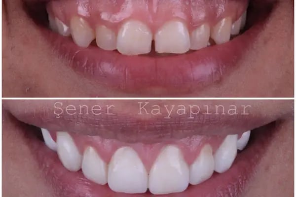 Dr. Şener KAYAPINAR Diş Kliniği - Resim 15