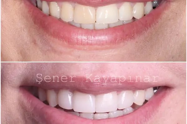 Dr. Şener KAYAPINAR Diş Kliniği - Resim 13