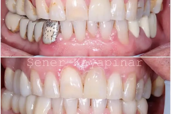 Dr. Şener KAYAPINAR Diş Kliniği - Resim 9
