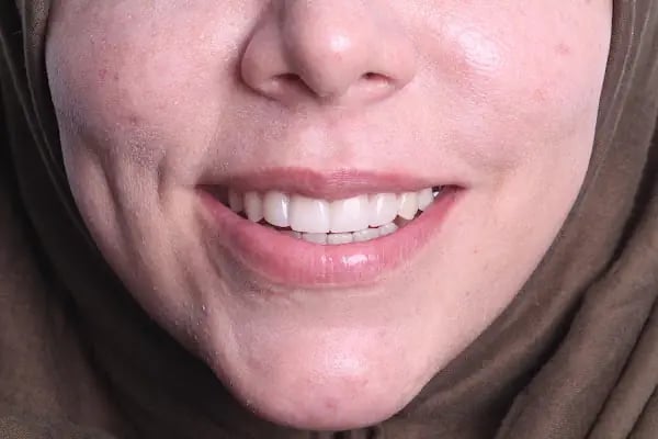 Dr. Şener KAYAPINAR Diş Kliniği - Resim 16