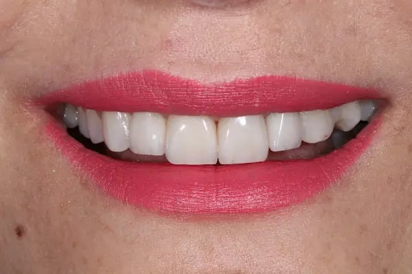 Dr. Şener KAYAPINAR Diş Kliniği - Resim 5