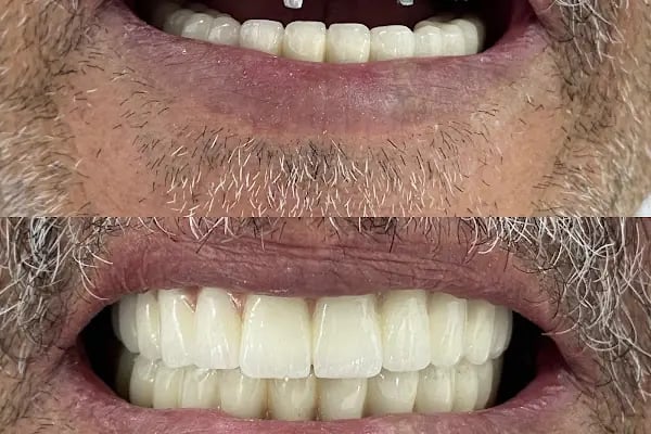 İlker Cemal Kavasoğlu Diş Kliniği / Dental İN Ağız Ve Diş Sağlığı Polikliniği / Dentalin - Resim 2