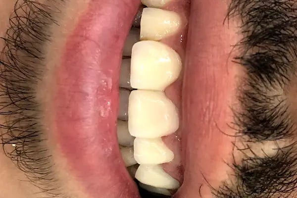 İlker Cemal Kavasoğlu Diş Kliniği / Dental İN Ağız Ve Diş Sağlığı Polikliniği / Dentalin - Resim 12