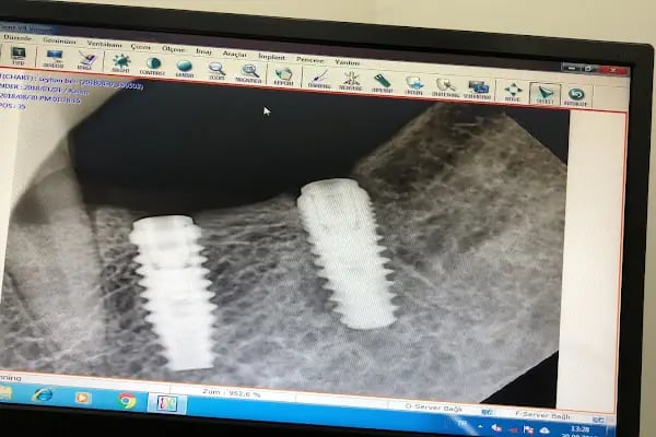 İlker Cemal Kavasoğlu Diş Kliniği / Dental İN Ağız Ve Diş Sağlığı Polikliniği / Dentalin - Resim 13
