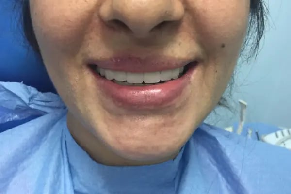 İlker Cemal Kavasoğlu Diş Kliniği / Dental İN Ağız Ve Diş Sağlığı Polikliniği / Dentalin - Resim 19