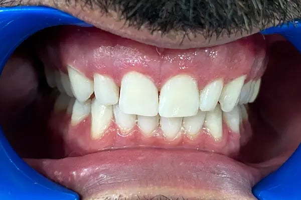 İlker Cemal Kavasoğlu Diş Kliniği / Dental İN Ağız Ve Diş Sağlığı Polikliniği / Dentalin - Resim 10