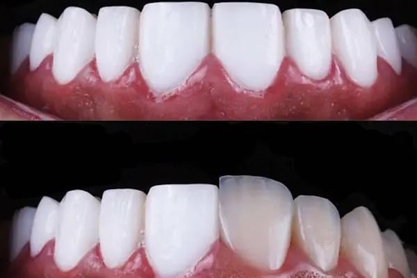 İlker Cemal Kavasoğlu Diş Kliniği / Dental İN Ağız Ve Diş Sağlığı Polikliniği / Dentalin - Resim 11