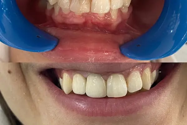 İlker Cemal Kavasoğlu Diş Kliniği / Dental İN Ağız Ve Diş Sağlığı Polikliniği / Dentalin - Resim 14