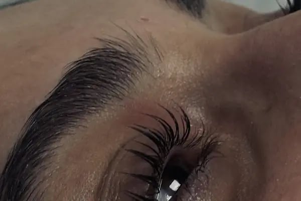 Ceylin özdemir beauty center - Resim 12