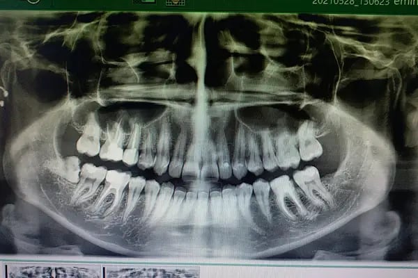 Konya dental center ağız ve diş sağlığı polikliniği - Resim 10