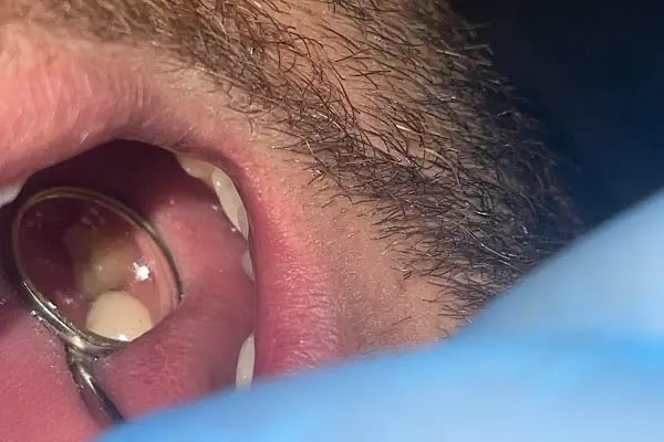 Konya dental center ağız ve diş sağlığı polikliniği - Resim 12
