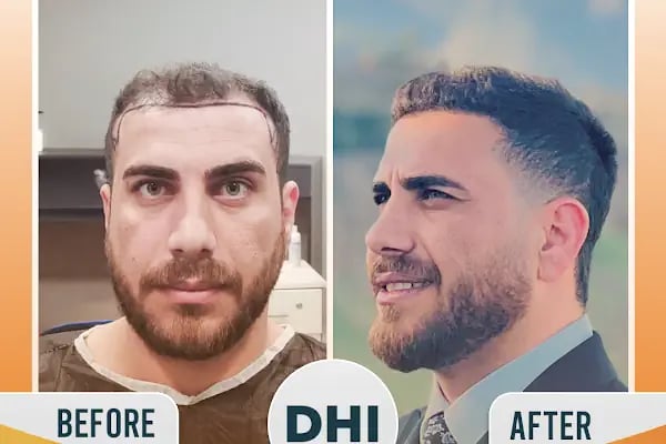 Regardhair Saç Ekim - Resim 15