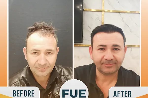 Regardhair Saç Ekim - Resim 14