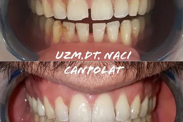 Denti Delil Ağız ve Diş Sağlığı Polikliniği Bağcılar şubesi - Resim 4