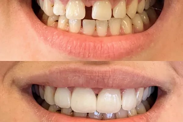 Doç Dr Murat Metin Ağız Diş Çene Cerrahisi Ve İmplant Kliniği - Resim 20