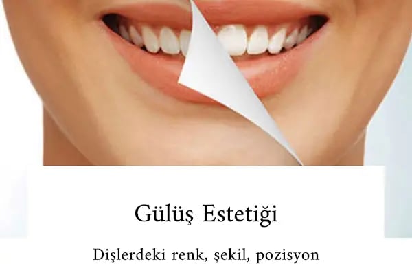Doç Dr Murat Metin Ağız Diş Çene Cerrahisi Ve İmplant Kliniği - Resim 7