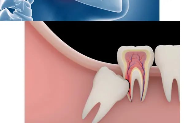 Doç Dr Murat Metin Ağız Diş Çene Cerrahisi Ve İmplant Kliniği - Resim 16