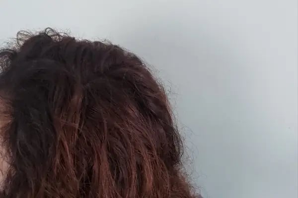 Anıl Erdoğmuş Hair Beauty - Resim 16