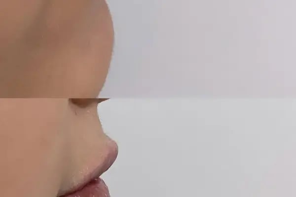 Op. Dr. Ahmet Akatekin Muayenehanesi - Konya Burun Estetiği, Estetik Cerrah Konya - Resim 4