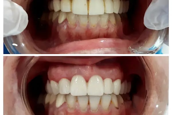 Özel Ensar dent Ağız ve Diş Sağlığı Polikliniği - Resim 12