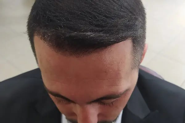Onur Turan Erkek Kuaförü - Resim 14
