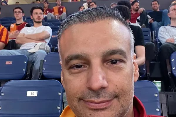 Serkan Aydin Hair Transplant - Resim 19