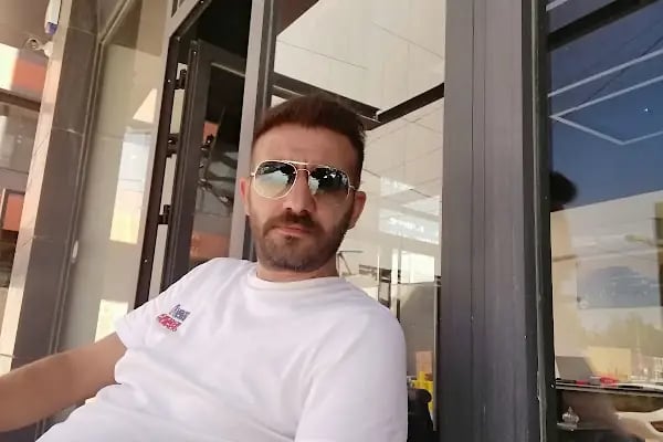 Serkan Aydin Hair Transplant - Resim 13