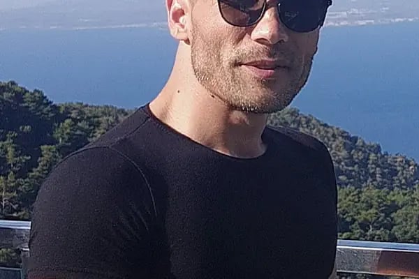 Serkan Aydin Hair Transplant - Resim 14
