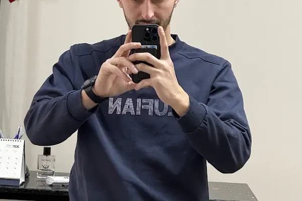 Serkan Aydin Hair Transplant - Resim 10
