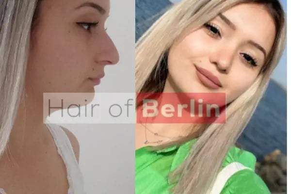 Hair of Berlin - Resim 5