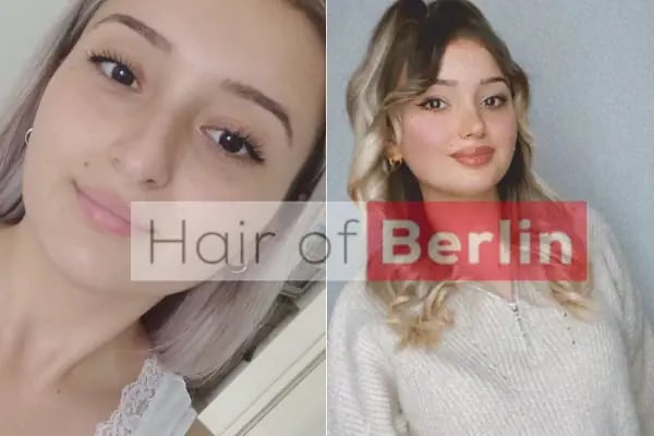 Hair of Berlin - Resim 10