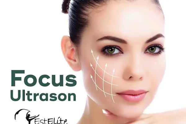 Estelite Klinik | Buz Lazer Epilasyon | Botoks | Dudak Dolgusu | Terleme Tedavisi - Resim 14