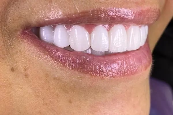 ALL Dental (Cleopatra) Alanya - Resim 16