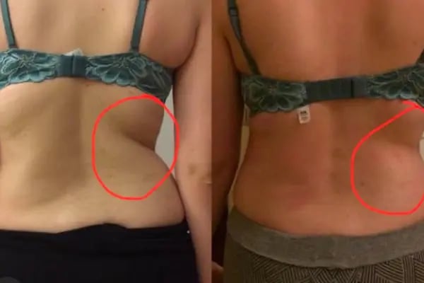 Uzman Fizyoterapist Tansu YAŞİN Fizyoterapi ve Skolyoz Merkezi - Resim 3