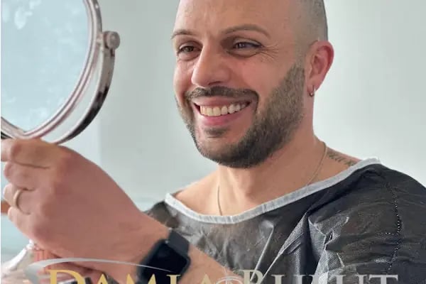 Damlabuluthairtrans Saç Ekim Kliniği - Resim 7