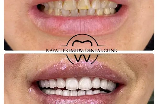 Kayalı Premium Ağız ve Diş Sağlığı Polikliniği - Resim 2