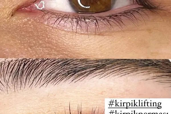 CLINIC-A KONYA GÜZELLİK MERKEZİ - Resim 17
