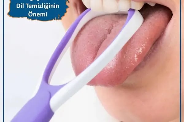 REHA DENT AĞIZ VE DİŞ SAĞLIĞI MERKEZİ - Resim 9