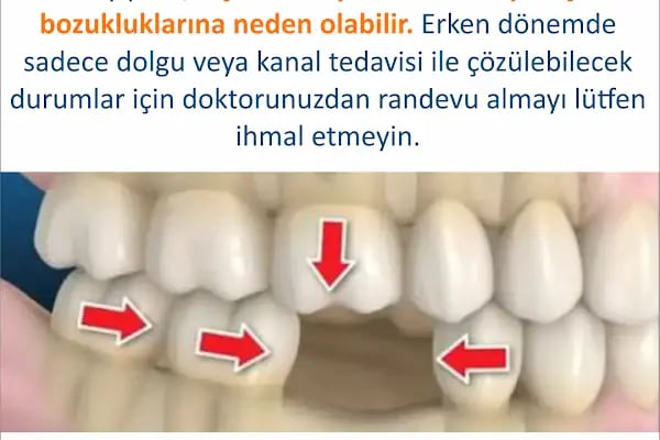 REHA DENT AĞIZ VE DİŞ SAĞLIĞI MERKEZİ - Resim 16