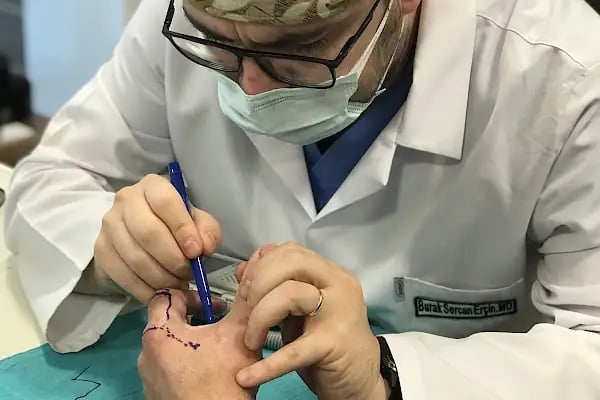 Doç. Dr. Burak Sercan Erçin, Plastik Rekonstrüktif Ve Estetik Cerrahi - Resim 10