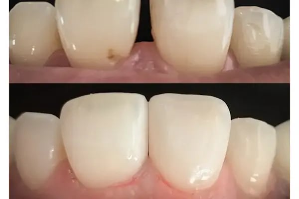 ARTDENT KLİNİK AĞIZ VE DİŞ SAĞLIĞI POLİKLİNİĞİ - Resim 20